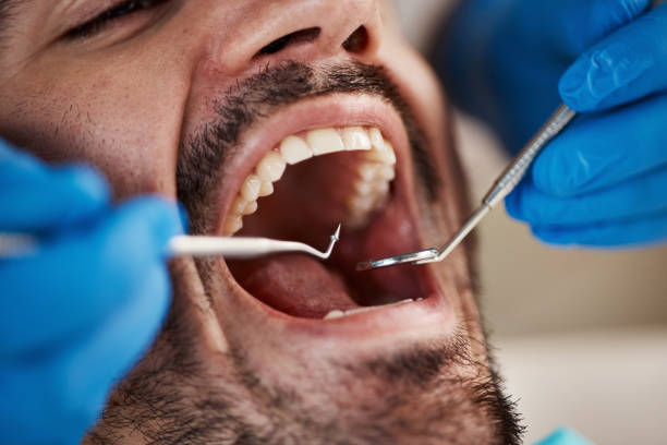 Best Cracked Tooth Emergency Dentist  in Pinckneyvle, IL